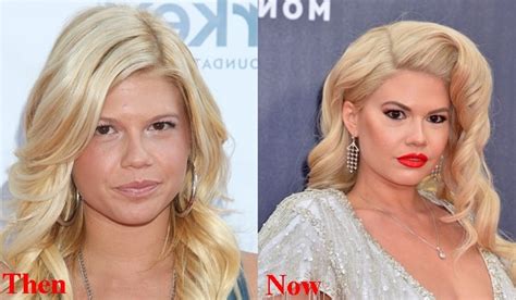 chanel west coast before and after|chelsea Chanel dudley pics.